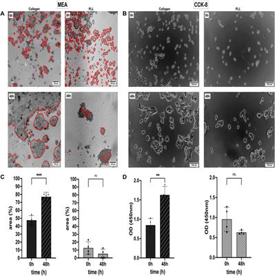 Assessment of chemotherapeutic effects on cancer cells using adhesion noise spectroscopy